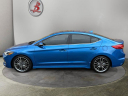 Thumbnail image of 2017 Hyundai ELANTRA at Low Book Sales