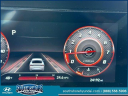 Thumbnail image of 2023 Hyundai ELANTRA at South Shore Hyundai