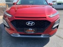 Thumbnail image of 2020 Hyundai KONA at Choice Auto