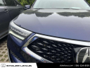 Thumbnail image of 2021 Acura RDX at Stoler Lexus